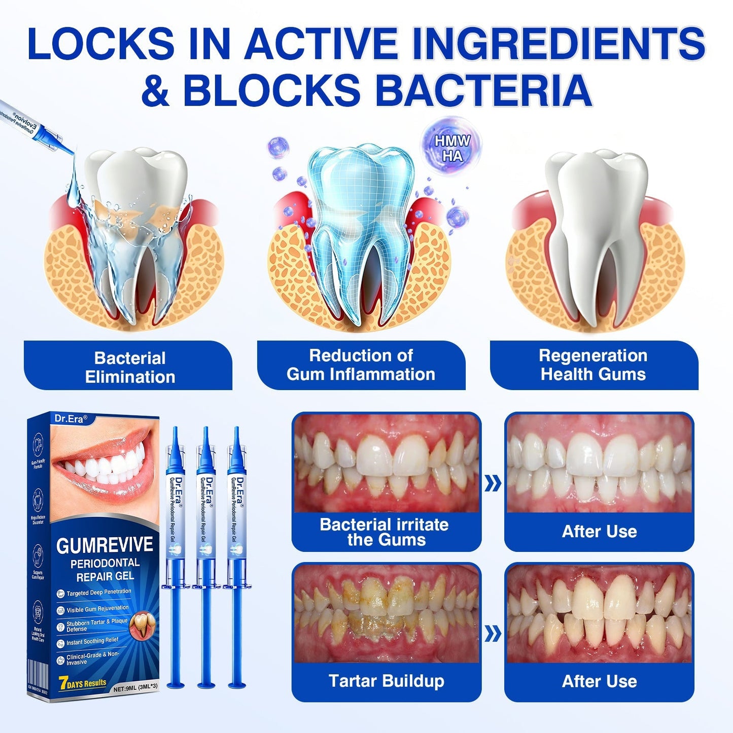 🇺🇸🏅🦷🛡️Dr.Era® GumRevive Periodontal Repair Gel
